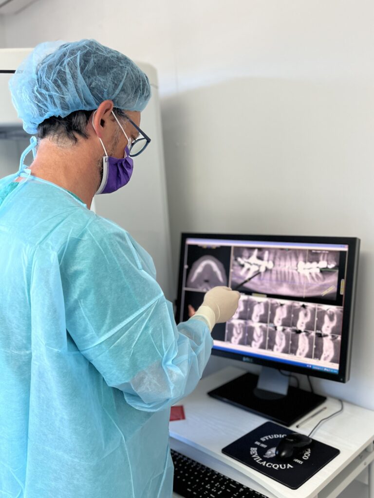 Marco Bevilacqua impianti dentali